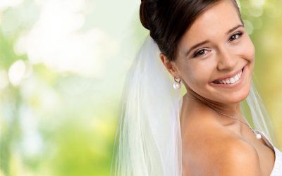 Prepare for Your Big Day with a Smile Makeover